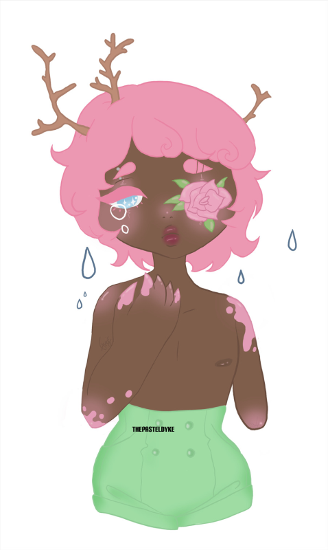 Character name: Teala. Character with brown skin with pink spots and pink hair, branches growing out of his hair. Instead of a left eye is a pink rose. His left arm ends above the elbow. He's shirtless, wearing pastel green shorts with a high waist. He's looking a bit sad, tears coming from his right eye.